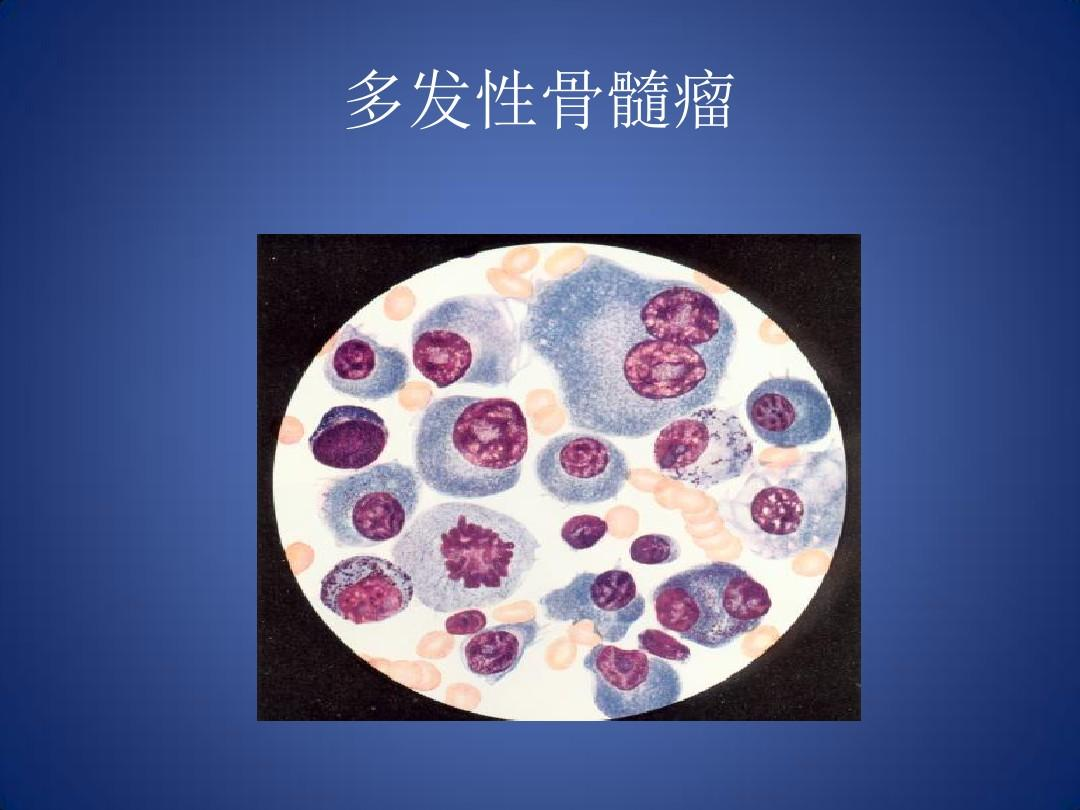 塞利尼索 (selinexor)仿制药的正确购买途径